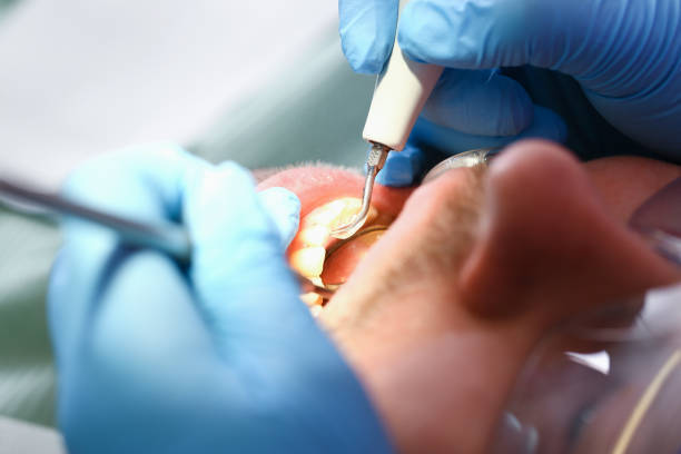 Urgent Tooth Repair in IL